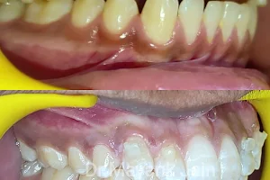 Smile and Sujok Dental Clinic l Best Dentist in Kota l Dentist near me l Braces and Aligner specialist l Best Dental Implants image