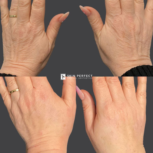 Explore feminine arm tattoo ideas, creative tattoo ideas in Whittier, available at Skin Perfect Medical Aesthetics