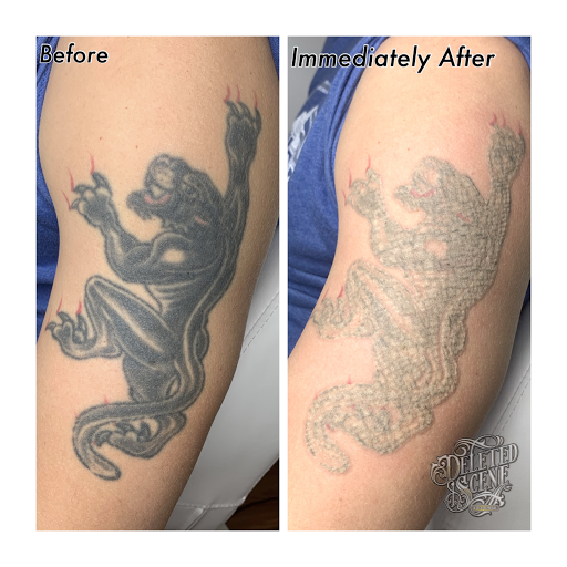 Explore astronomy tattoo ideas, creative tattoo ideas in Hatboro, available at Deleted Scene Tattoo Removal