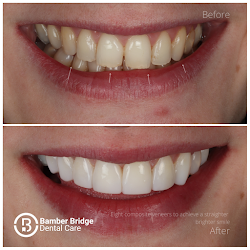 Bamber Bridge Dental Care