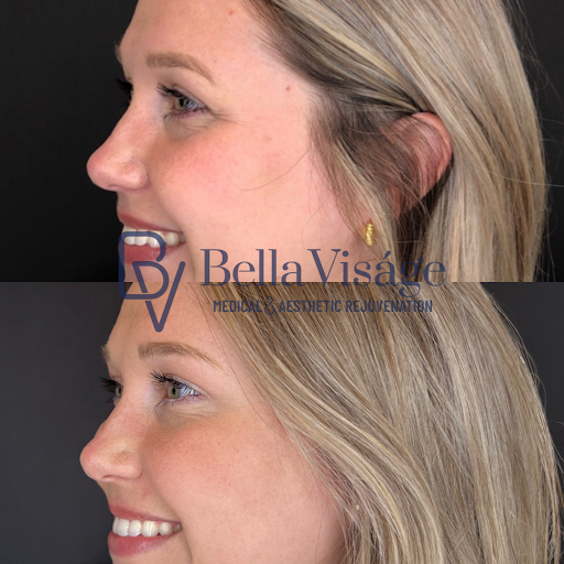 Explore skinny tattoo ideas, creative tattoo ideas in Lakeland, available at Bella Visge Medical & Aesthetic Rejuvenation