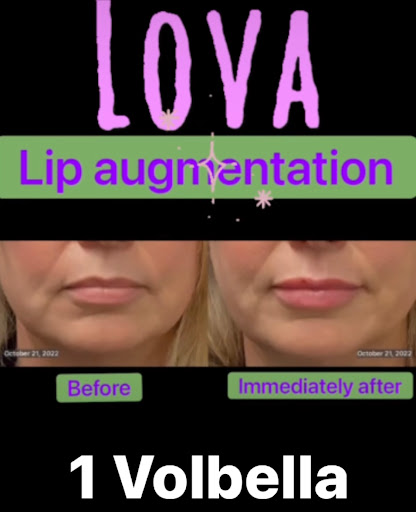 Explore face tattoo cover up ideas, creative tattoo ideas in Lake Oswego, available at Lake Oswego Vein and Aesthetic LOVA