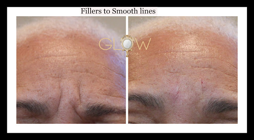 Glow Aesthetic Center Encino image