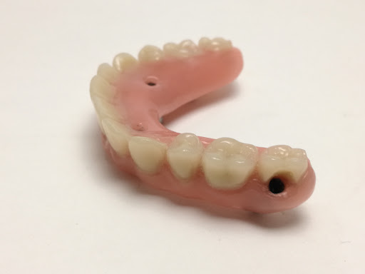 Información y opiniones sobre Protesico Dental Sevilla – Seprolab dental de Sevilla