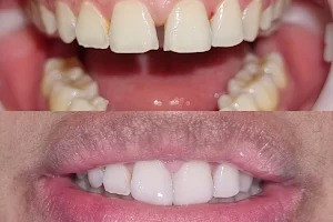 Dental Carrion image