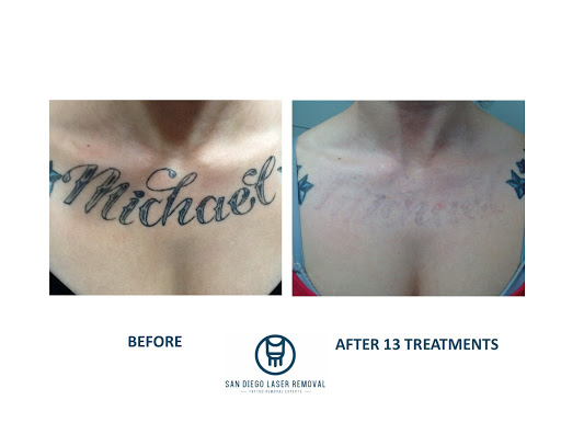 Find family meaning tattoo ideas for your next unique tattoo in San Diego at Removery Tattoo Removal & Fading