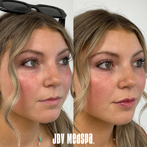 Explore june birth flower tattoo ideas, creative tattoo ideas in Canton, available at JDV Med Spa