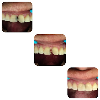 Dr Nandha Dental Clinic And Implant Centre - Dr Nandha Dental Clinic And Implant Centre
