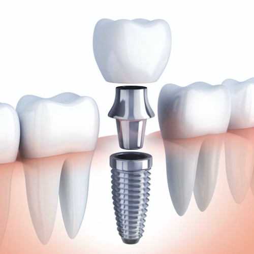 Dentalite Clinic - Cabinet Stomatologic Popesti Leordeni - Dentist