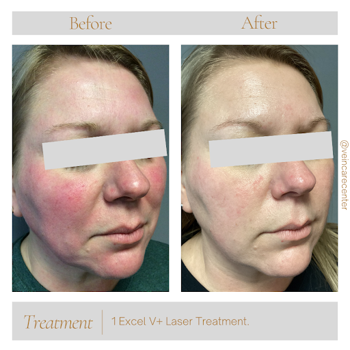 Explore precious moments tattoos ideas, creative tattoo ideas in Lima, available at Vein Care Center Laser Specialists