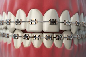 Shree Orthodontics Dental Clinic | Dentist | Root Canal Treatment| Braces | Implant in vishal nagar/wakad/pimple saudagar image