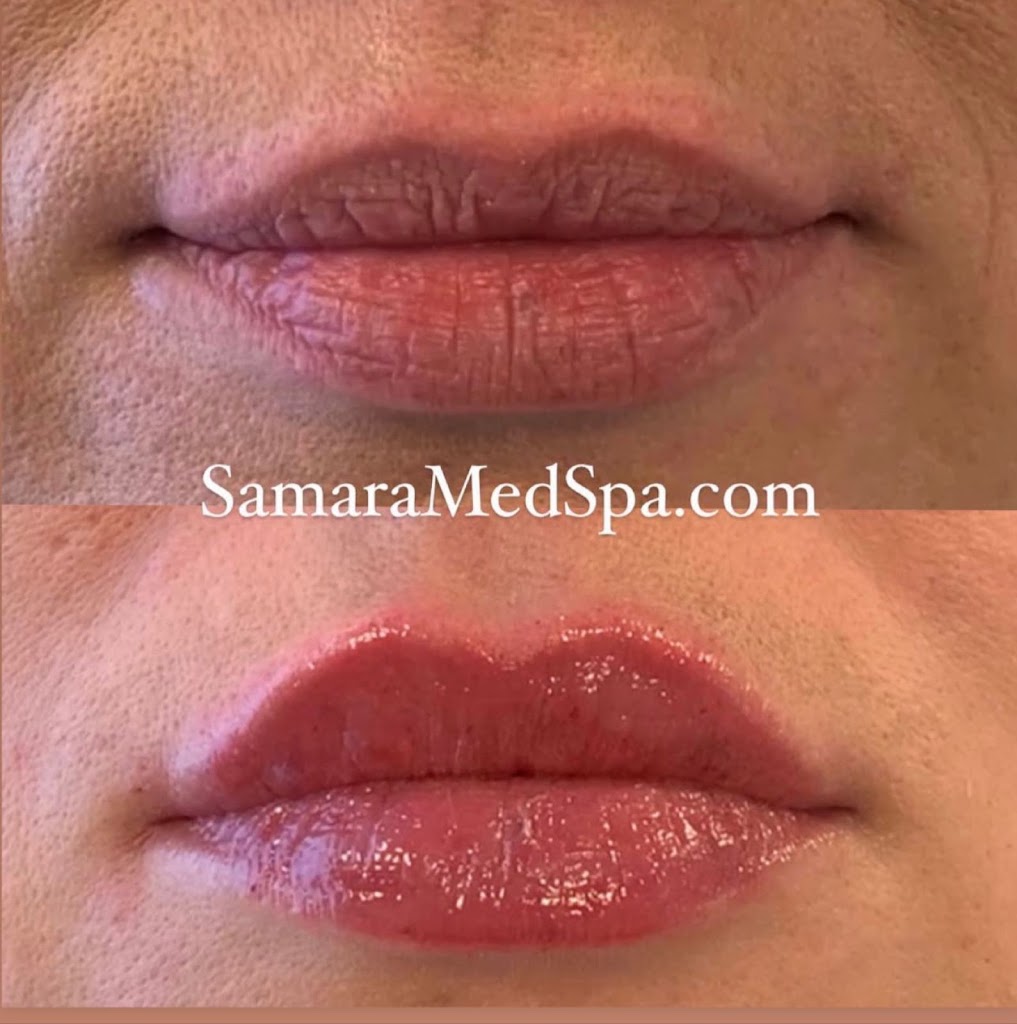 Samara MedSpa Avon / Simsbury 06070