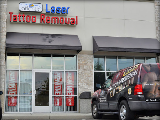 Explore cool elbow tattoo ideas, creative tattoo ideas in Virginia Beach, available at Atlantic Laser Tattoo Removal