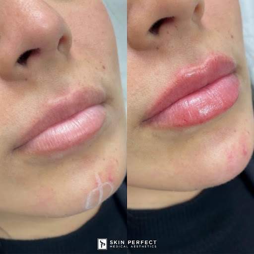 Explore king of hearts tattoo ideas, creative tattoo ideas in Whittier, available at Skin Perfect Medical Aesthetics