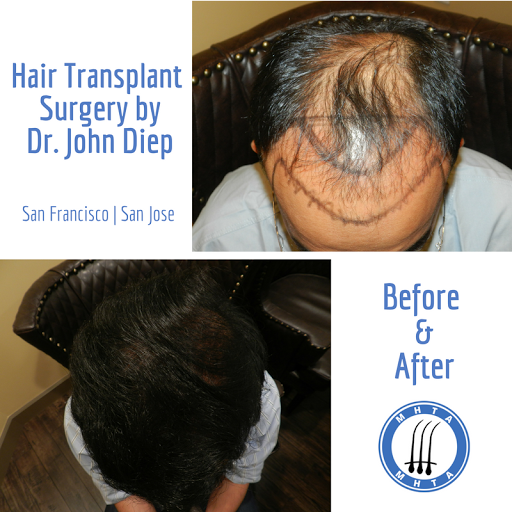 Hair Replacement Service «Medical Hair Transplant & Aesthetics», reviews and photos, 490 Post St #1701, San Francisco, CA 94102, USA