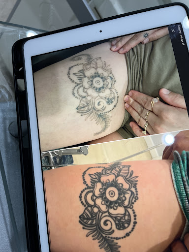 Explore baltimore orioles tattoo ideas, creative tattoo ideas in Hermosa Beach, available at Removery Tattoo Removal & Fading