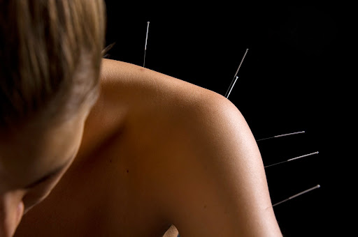 The Acupuncture Works