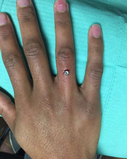 Explore ring tattoo cover up ideas, creative tattoo ideas in Philadelphia, available at Daves Artistic Tattoo