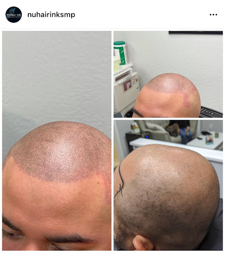 Explore lion forearm tattoo ideas, creative tattoo ideas in Roseville, available at NuHair Ink. Scalp MicroPigmentation & Aesthetic Clinic of Sacramento