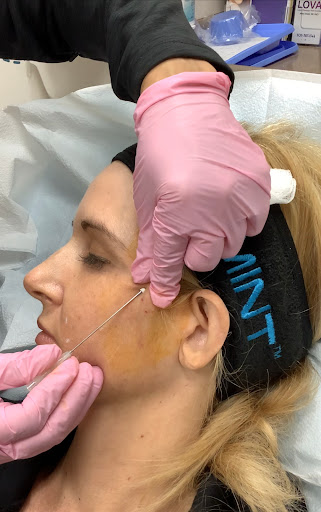 Explore itachi uchiha tattoo ideas, creative tattoo ideas in Lake Oswego, available at Lake Oswego Vein and Aesthetic LOVA