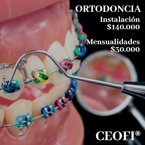 Opiniones de Centro de Especialidades Odontológicas Frontera del Inca en Linares - Dentista
