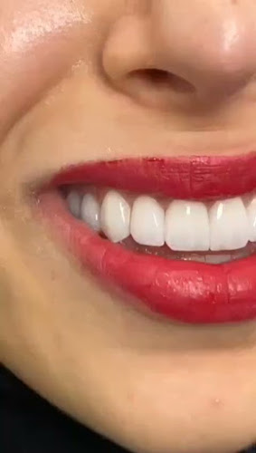 Opinii despre معمل زركون الماسي لتركيبات الاسنانDiamond Zercon Dental Lab în الرياض - مختبر
