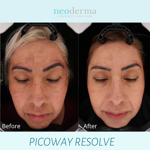 Explore demon slayer tattoo ideas small, creative tattoo ideas in Anaheim, available at Neoderma