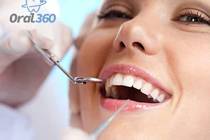 Dentista Tijuca | Implantes Dentários | Clínica Odontológica Oral 360 image