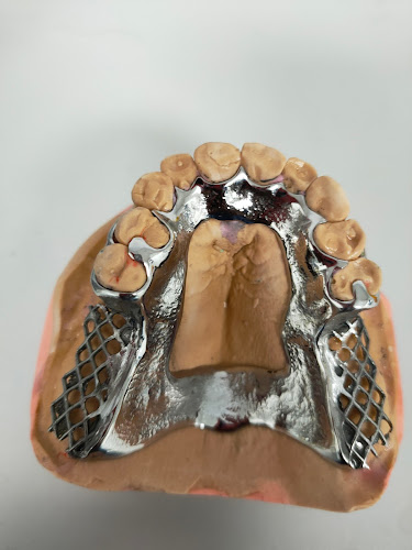 Centre de prothèses dentaires Laboratoire Dentaire Kady Diakité Romorantin-Lanthenay