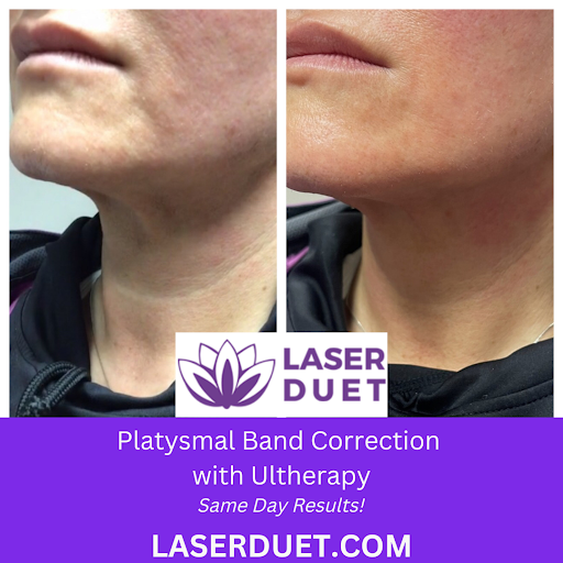 Explore gangster sleeve tattoo ideas, creative tattoo ideas in Dearborn, available at Laser Duet Med Spa