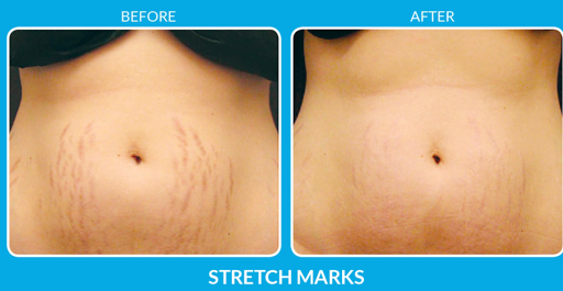 Hair Salon «Estate Beauty Hair Salon», reviews and photos, Estate Beauty Hair Salon, 8515 California Route 2, West Hollywood, CA 90069, USA