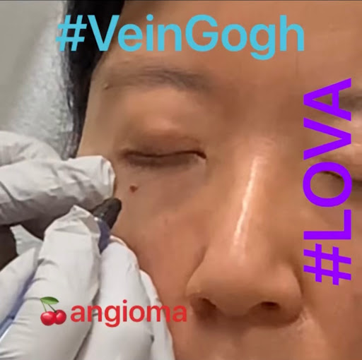 Explore orange county tattoo ideas, creative tattoo ideas in Lake Oswego, available at Lake Oswego Vein and Aesthetic LOVA