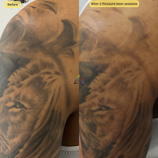 Find background tattoo ideas for guys for your next unique tattoo in New York at Ag2g Laser Tattoo Removal & MedSpa