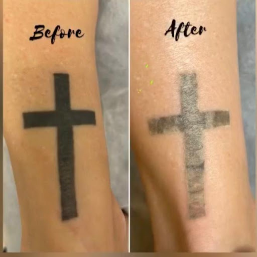 Explore bee tattoo ideas for women, creative tattoo ideas in Hallandale, available at Laser Treatments by Ageless Body Clinic