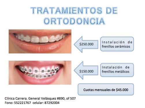 Clínica Dental Carrera - Antofagasta