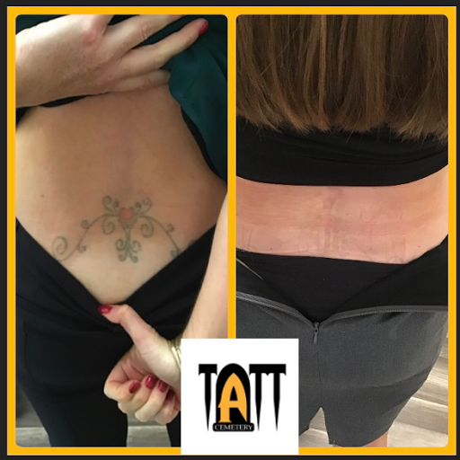 Explore chest tattoo ideas, creative tattoo ideas in Fort Myers, available at Laser Tattoo Removal by Tatt Cemetery