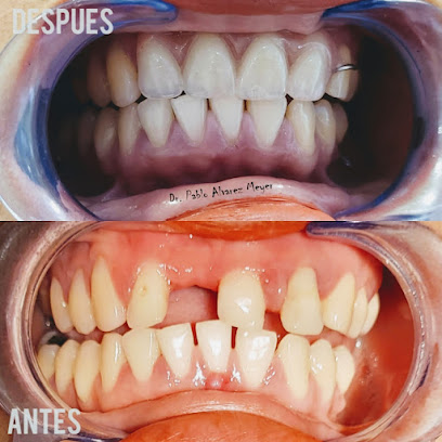 Clínica DentalDens San Vicente TT