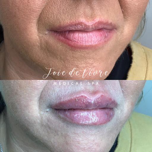 Explore tattoo ideas for last name, creative tattoo ideas in Canton, available at JDV Med Spa