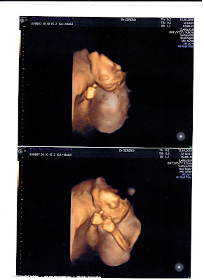 CABINET D'ECHOGRAPHIE DU DOCTEUR SERERO à Paris