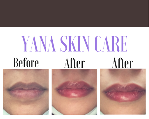 Laser Hair Removal Service «Yana Skin Care», reviews and photos, 3101 Richmond Ave #200, Houston, TX 77098, USA