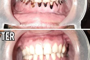 MEDI DENT - Multi speciality Dental Clinic & Implant Centre image