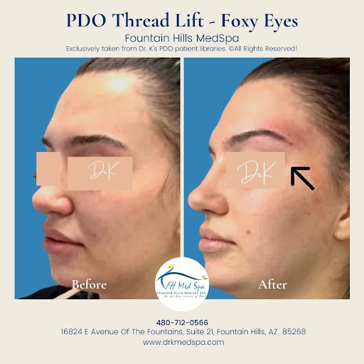 Pediatrician «Dr. Jyoti Patel MD - Fountain Hills Pediatrics & Internal Medicine», reviews and photos, 13620 N Saguaro Blvd #100, Fountain Hills, AZ 85268, USA