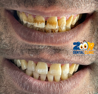 Zoom Dental clinic د. حازم عبدالرحمن