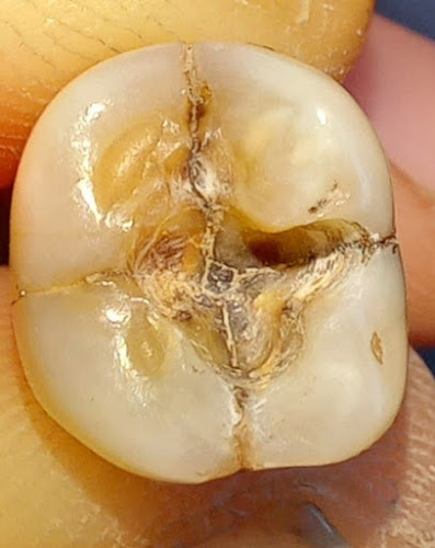 Clínica Dental Dentista a Domicilio - Dentista