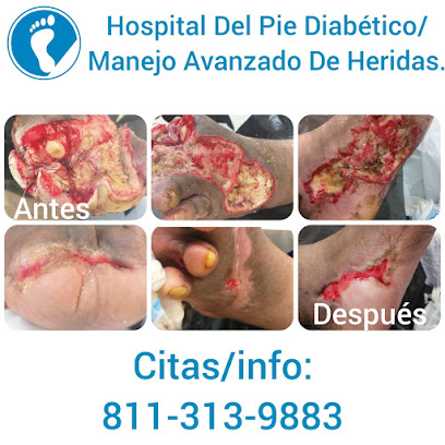 HOSPITAL DEL PIE DIABÉTICO/ MANEJO AVANZADO DE HERIDAS