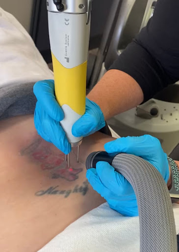 Explore fallen soldier tattoo ideas, creative tattoo ideas in Grand Island, available at Revive Laser