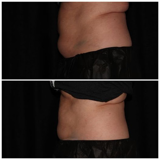 Medical Spa «Docere Medical Spa & Laser Center», reviews and photos, 10633 Pearl Rd, Strongsville, OH 44136, USA