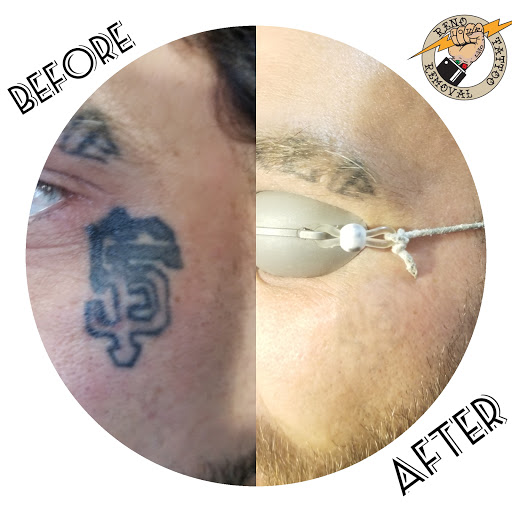 Explore mens sleeve tattoo idea, creative tattoo ideas in Reno, available at Reno Tattoo Removal