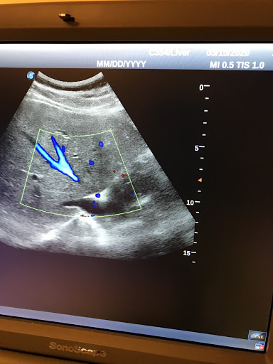 Fousse Diagnostic Ultrasound. Pregnancy, Abdomen, Pelvic, Small Parts, Vascular Doppler, etc..Ultrasonido 2D/3D/4D