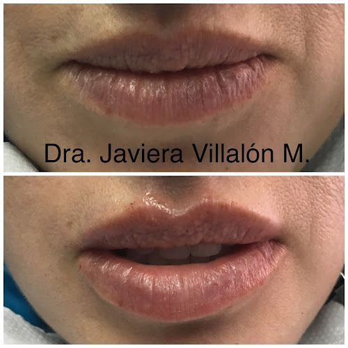 Dra. Javiera Villalón M. (Clínica Vitalzone) - Dentista